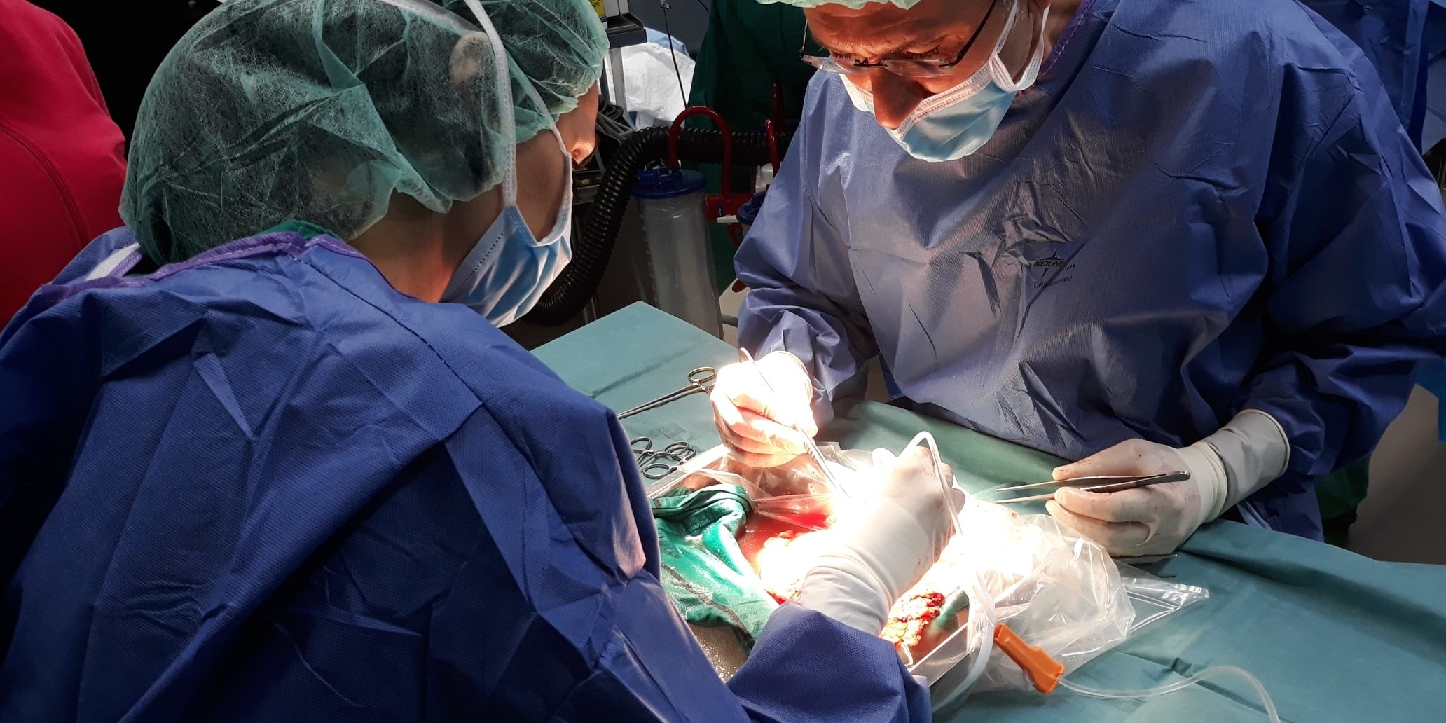 Tx renal de vivo- perfusión riñón