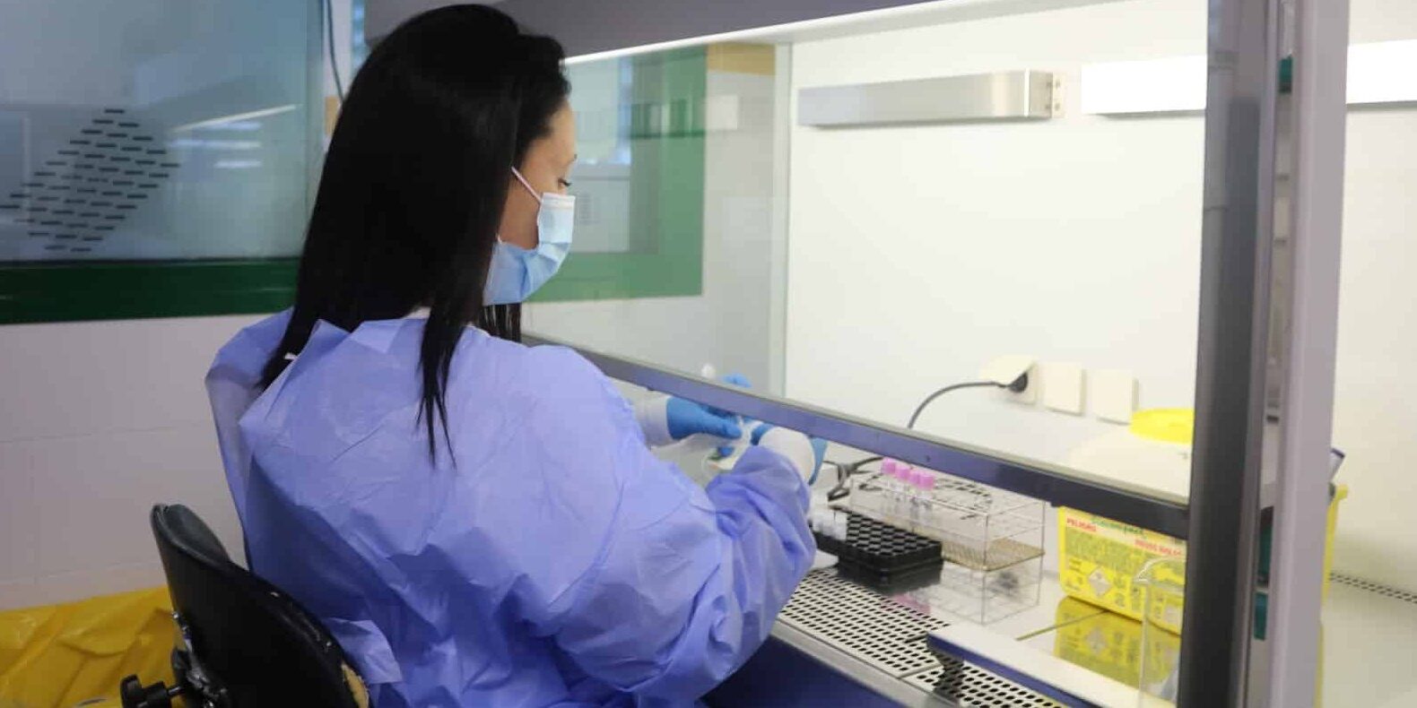 SANIDAD INFORMA DE QUE EL BROTE DE SALMONELLA EN GRAN CANARIA AFECTA A DIECISIETE PERSONAS 22-8-25