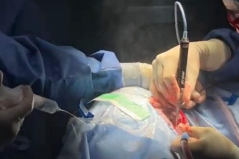 Curso ORL implante osteointegrado