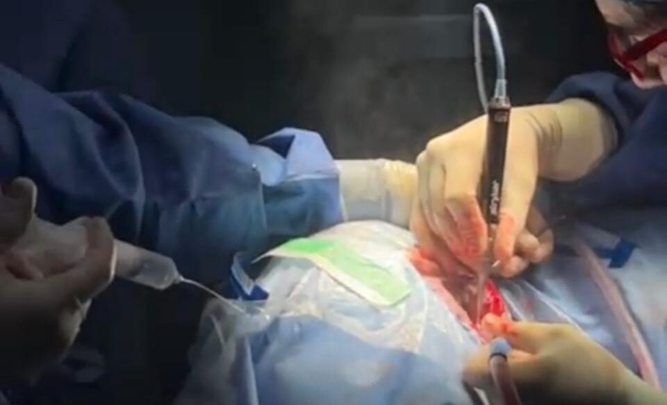 Curso ORL implante osteointegrado