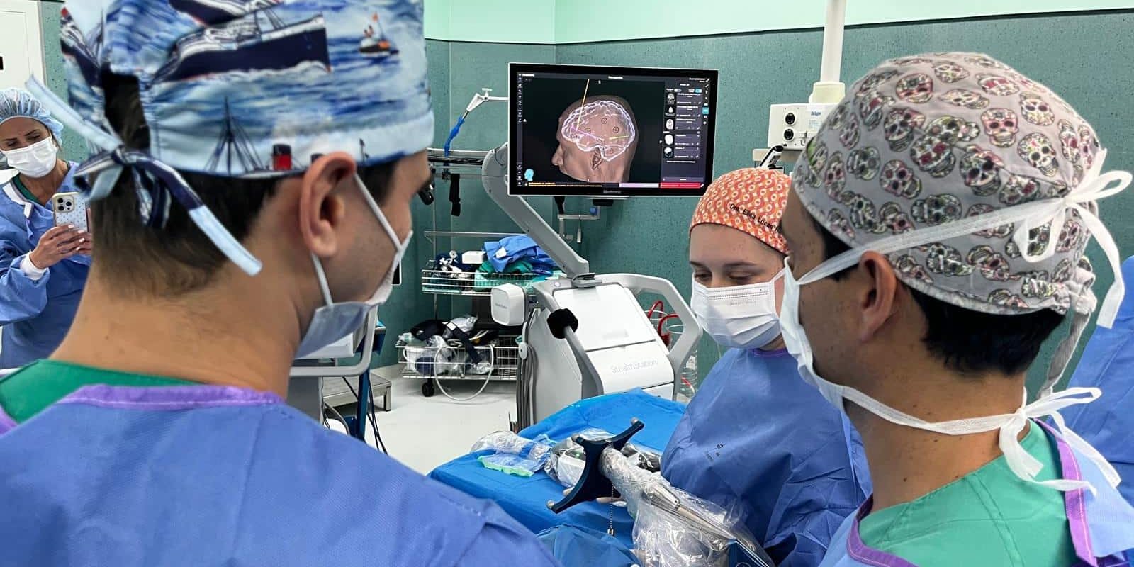 15jun Primera SEEG epilepsia refractaria3