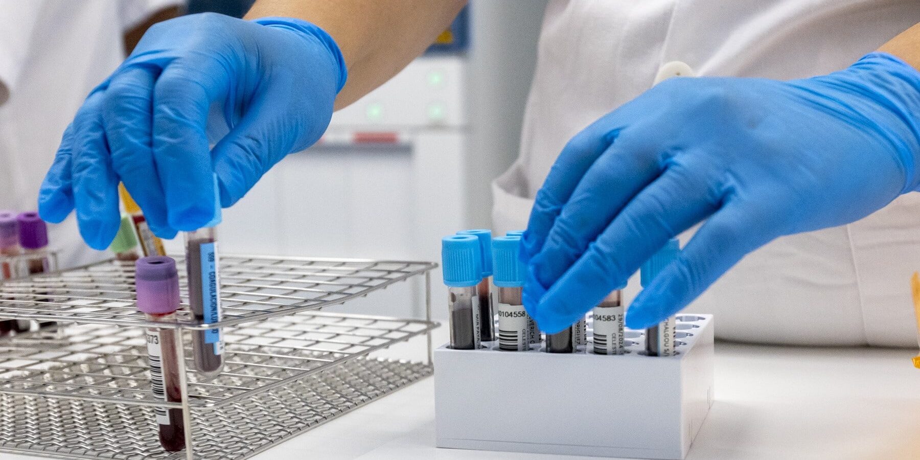 SANIDAD NOTIFICA EN TENERIFE UN BROTE DE SARAMPIÓN CON CUATRO CASOS CONFIRMADOS 23-6-26
